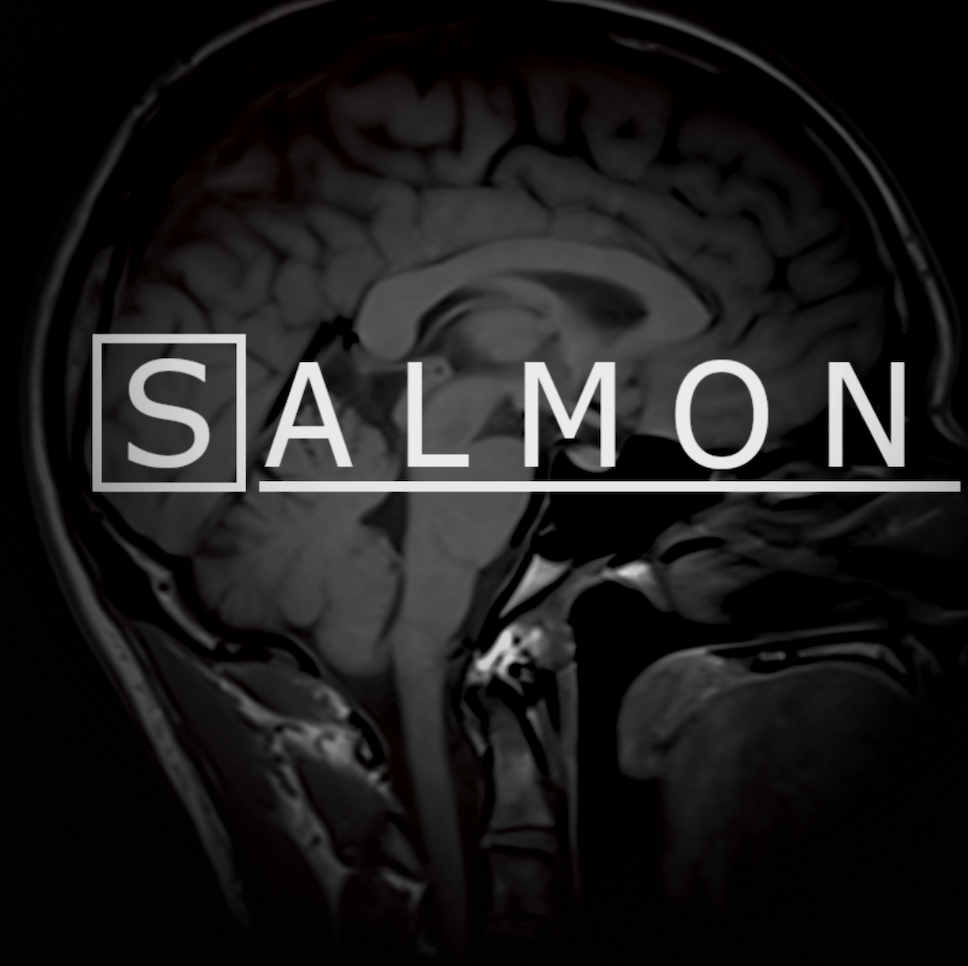 Duncan's Brain - My Brain MRI