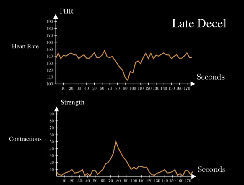YouTube Animations - NST Decels